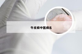 牛皮癣中医病名