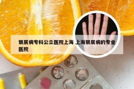 银屑病专科公立医院上海 上海银屑病的专业医院