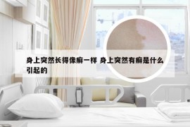 身上突然长得像癣一样 身上突然有癣是什么引起的