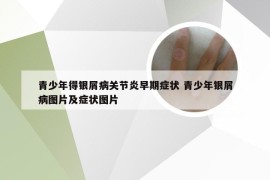 青少年得银屑病关节炎早期症状 青少年银屑病图片及症状图片