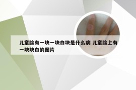 儿童脸有一块一块白块是什么病 儿童脸上有一块块白的图片