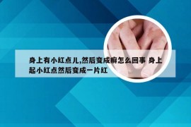 身上有小红点儿,然后变成癣怎么回事 身上起小红点然后变成一片红