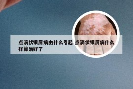 点滴状银屑病由什么引起 点滴状银屑病什么样算治好了