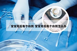 宝宝耳后有个白斑 宝宝耳后有个白斑怎么办