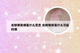 皮肤银屑病是什么意思 皮肤银屑是什么引起的病