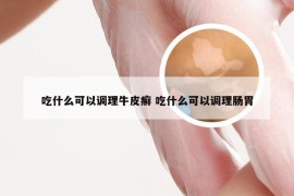 吃什么可以调理牛皮癣 吃什么可以调理肠胃