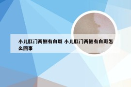 小儿肛门两侧有白斑 小儿肛门两侧有白斑怎么回事