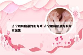 济宁银屑病最好的专家 济宁银屑病最好的专家医生