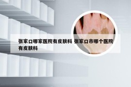 张家口哪家医院有皮肤科 张家口市哪个医院有皮肤科