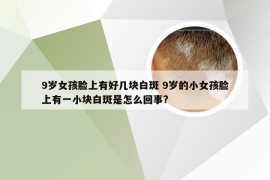 9岁女孩脸上有好几块白斑 9岁的小女孩脸上有一小块白斑是怎么回事?