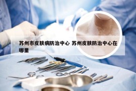 苏州市皮肤病防治中心 苏州皮肤防治中心在哪里