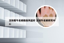 沈阳看牛皮癣敞南风超好 沈阳牛皮癣研究中心