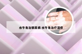 水牛角治银屑病 水牛角治疗湿疹