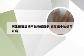 医生说银屑病不做吸烟限制 银屑病少抽烟可以吗