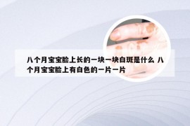 八个月宝宝脸上长的一块一块白斑是什么 八个月宝宝脸上有白色的一片一片