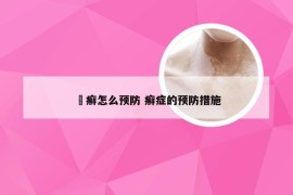 瘨癣怎么预防 癣症的预防措施