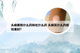 头癣要擦什么药和吃什么药 头癣买什么药擦效果好?