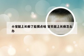 小宝腿上长癣了能摸点啥 宝贝腿上长癣怎么办
