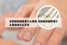 皮肤越抓越痒是什么原因 皮肤越抓越痒是什么原因用什么药膏
