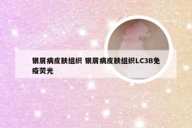 银屑病皮肤组织 银屑病皮肤组织LC3B免疫荧光