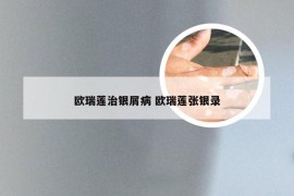 欧瑞莲治银屑病 欧瑞莲张银录