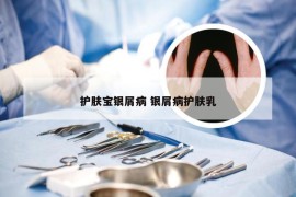护肤宝银屑病 银屑病护肤乳