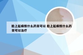 脸上起癣擦什么药膏可以 脸上起癣擦什么药膏可以治疗