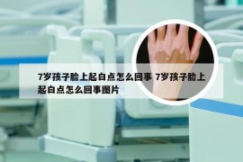 7岁孩子脸上起白点怎么回事 7岁孩子脸上起白点怎么回事图片