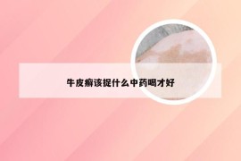 牛皮癣该捉什么中药喝才好