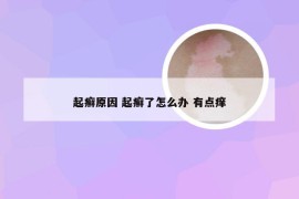 起癣原因 起癣了怎么办 有点痒