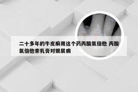 二十多年的牛皮癣用这个药丙酸氯倍他 丙酸氯倍他索乳膏对银屑病