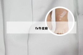 fx牛皮癣