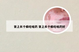 背上长个癣吃啥药 背上长个癣吃啥药好