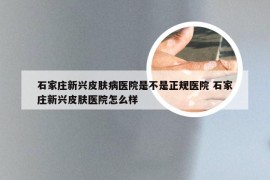 石家庄新兴皮肤病医院是不是正规医院 石家庄新兴皮肤医院怎么样
