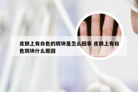 皮肤上有白色的斑块是怎么回事 皮肤上有白色斑块什么原因