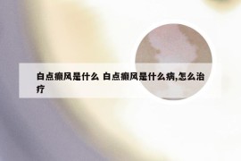 白点癫风是什么 白点癫风是什么病,怎么治疗