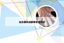 治白癜风成都哪家医院好