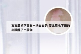 宝宝眉毛下面有一块白白的 婴儿眉毛下面的皮肤起了一层伽