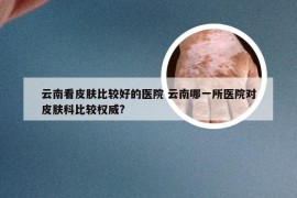 云南看皮肤比较好的医院 云南哪一所医院对皮肤科比较权威?