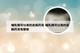 哺乳期可以用的皮癣药膏 哺乳期可以用的皮癣药膏有那些