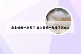 身上长癣一年多了 身上长癣一年多了怎么办
