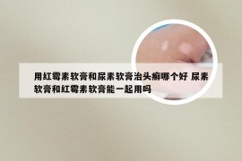 用红霉素软膏和尿素软膏治头癣哪个好 尿素软膏和红霉素软膏能一起用吗