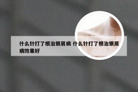 什么针打了根治银屑病 什么针打了根治银屑病效果好