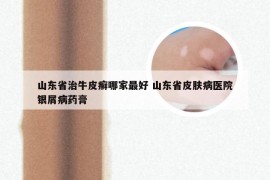 山东省治牛皮癣哪家最好 山东省皮肤病医院银屑病药膏