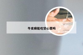 牛皮癣能吃空心菜吗