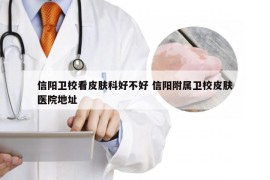 信阳卫校看皮肤科好不好 信阳附属卫校皮肤医院地址