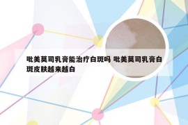 吡美莫司乳膏能治疗白斑吗 吡美莫司乳膏白斑皮肤越来越白