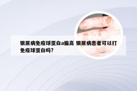 银屑病免疫球蛋白a偏高 银屑病患者可以打免疫球蛋白吗?