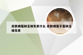 皮肤病是缺乏维生素什么 皮肤病是不是缺乏维生素