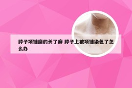 脖子项链磨的长了癣 脖子上被项链染色了怎么办